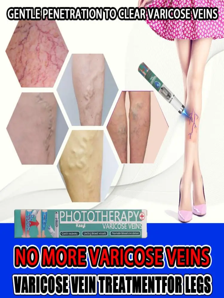 Rivelare le gambe stanche e doloranti |   Laser medico per vene varicose e ragno |   Stimolare il flusso sanguigno: anche sulle pelli sensibili