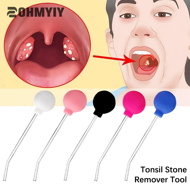 

Tonsil Stone Remover Tool Manual Style Remover Mouth Cleaning Care Tool Ear Wax Tonsil Stone Remover Cleaning Tool Random Color