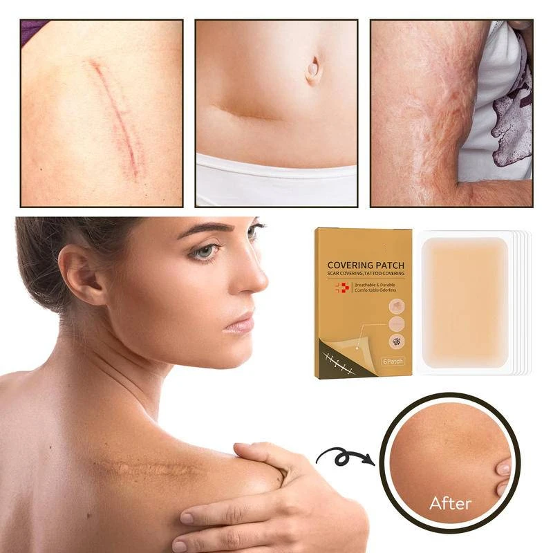 6 Stück Silikon Narben flecken Entfernung unsichtbare Concealer Pad Gel wasserdichte Band behandlung für C-Abschnitt Keloid brennt Bauchs traffung