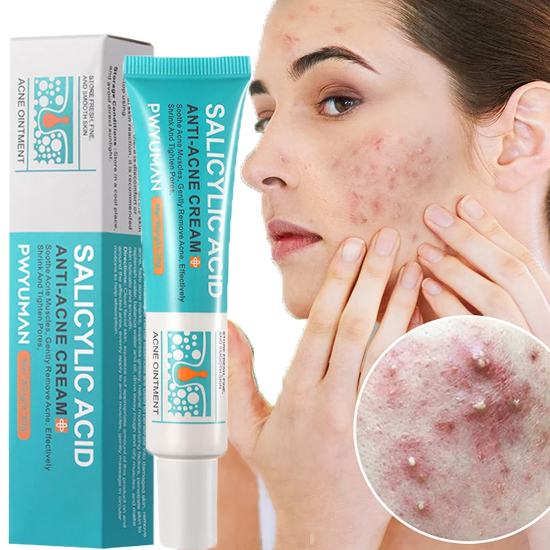 Salicylic Acid Acne Serum Cream Effective Treatment Hip Butt Acne Face Acne Back Acne Fade Acne Marks Whitening Smooth Skin Care