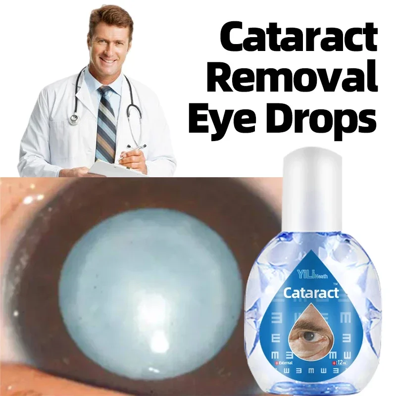 

Cataract Treatment Eye Drops 12Ml Eyesight Improvement Eye Discomfort Blurred Vision And Presbyopia Glaucoma Removal Medicine