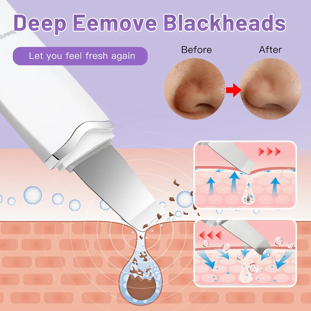 Épurateur de peau électrique à ultrasons, spatule vibrante pour le visage, dissolvant de points noirs, Lifting du visage, nettoyage, soins de la peau à ultrasons