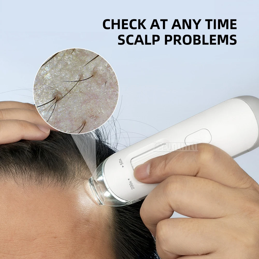 Professional Smart Home Scalp Hair Follicle Detector Skin Analysis Tool for Scalp Health And Hair Growth