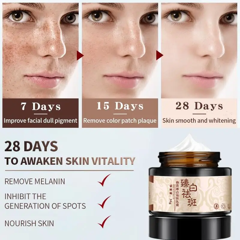 Powerful whitening freckle cream plant face cream remove freckles and dark spots 30g