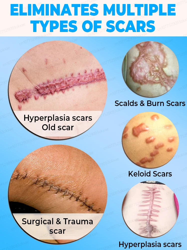 100% beautiful and flawless skin