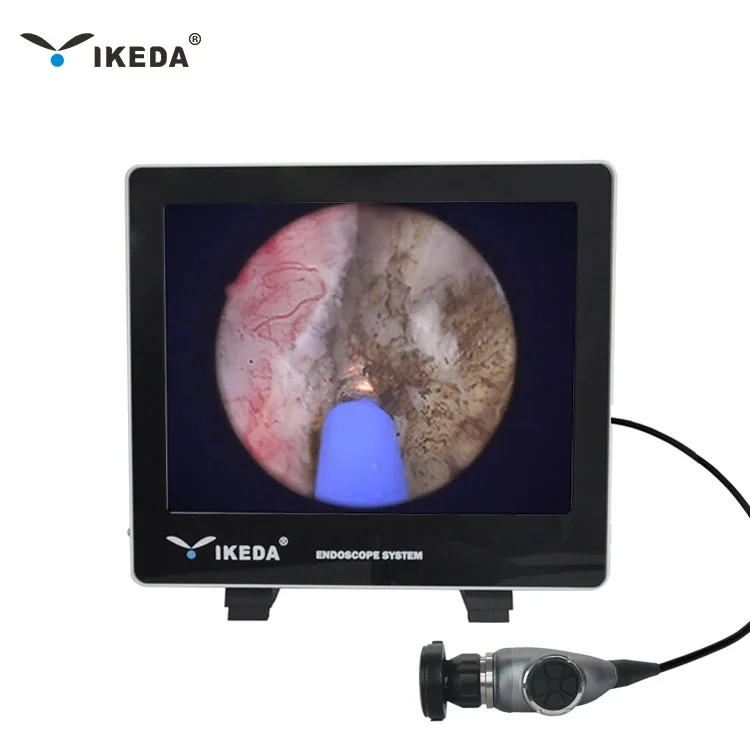 OEM Factory SD FHD Medical Endoscopic  System Portable ENT Nasal Surgery Endoscope Equipment