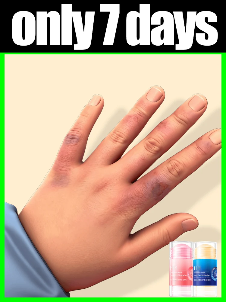 

Fear no winter. Vaseline 10x moisturizing hand and foot cream. Super hydrating. Cylindrical design, ready to use upon rotation