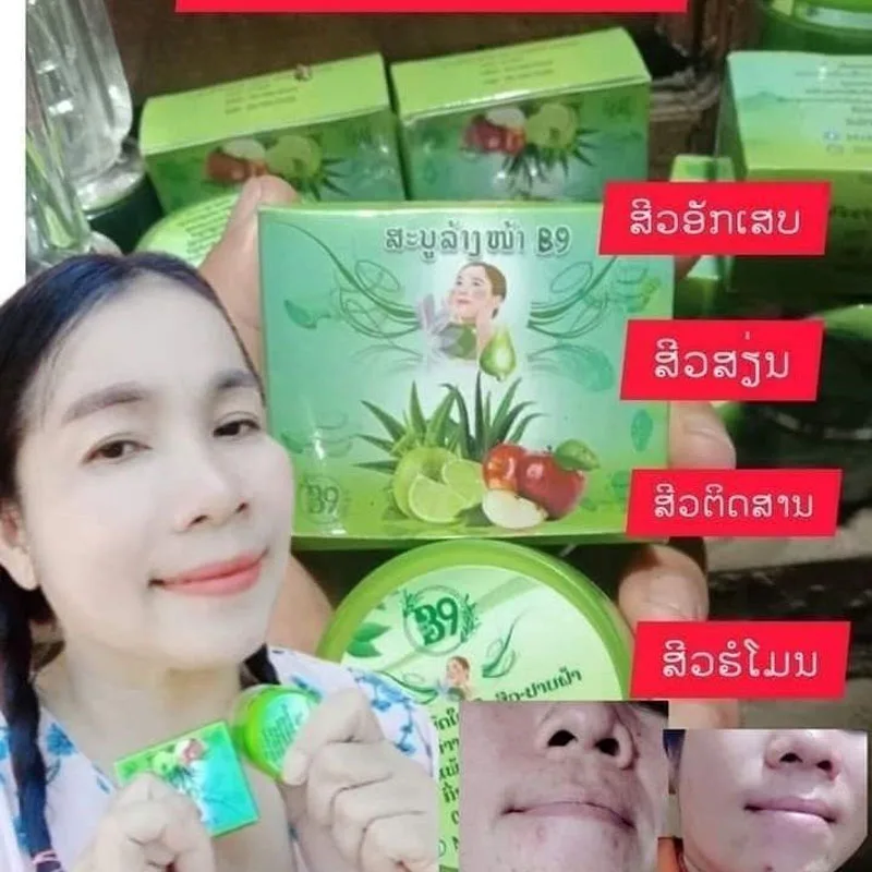 Thailand Laos B9 Skin Bright White Set, Removes Dull Skin Blemishes, Spots, Acne, Moisturizes Brightening Lightening Smooth Skin