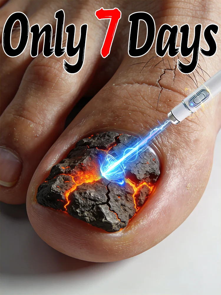 Quickly Restores Shine and Reduces Worries. Blue Light Pen Remove Onychomycosis Free Shipping