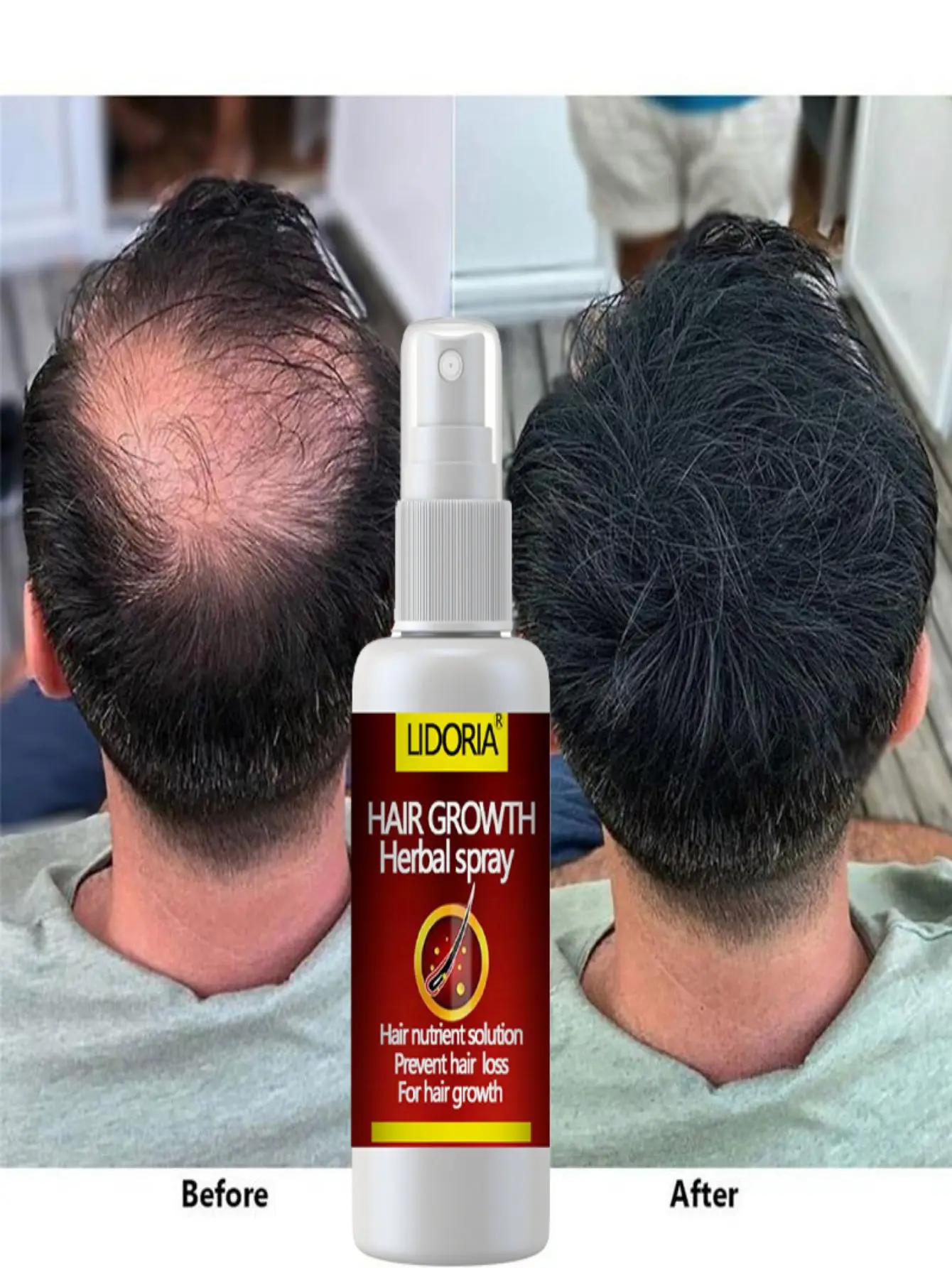 Original Hair Loss Essential Oils Natural Grow Hair Faster Regrowth Ginger Fast Hair Growth Repair Damaged Hair Care