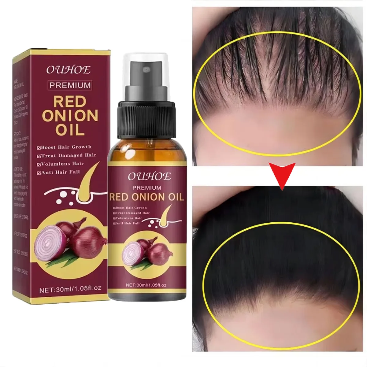 

7 Days Fast Hair Growth Serum Spray Anti Hairs Loss Treatment Product Repair Nourish Roots Regrowth Thicken Hair Care Men Women