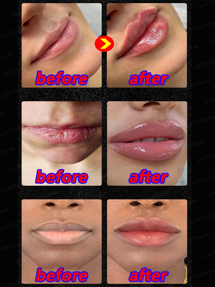 Three-dimensional plump lips, a more charming smile, 100% effective