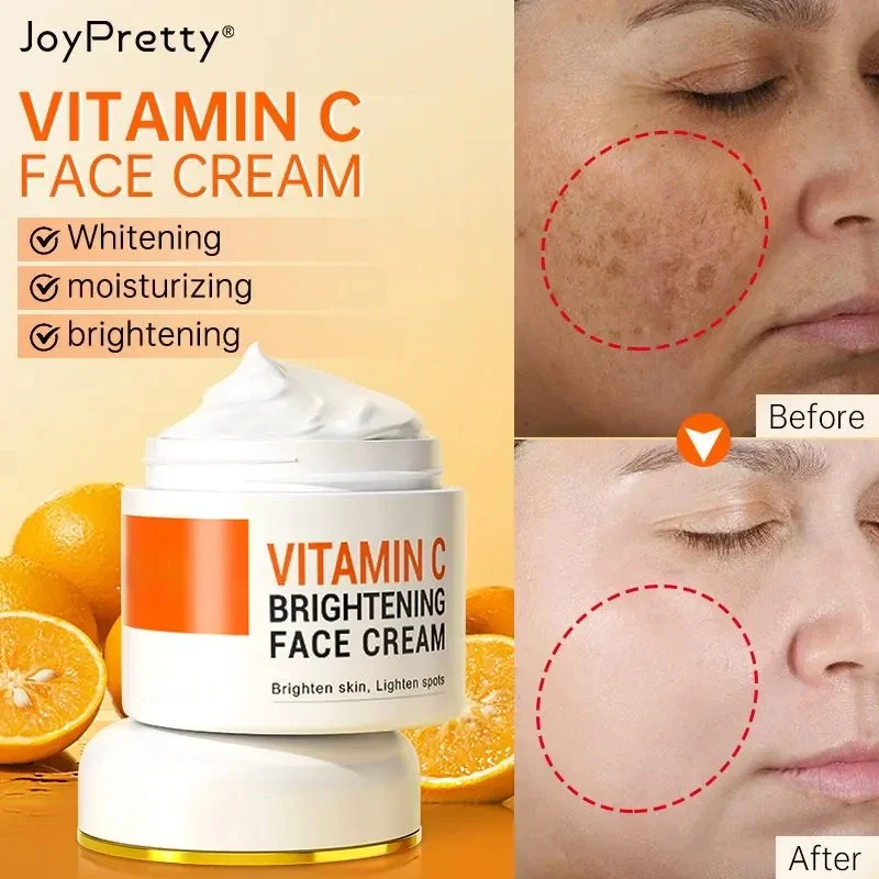 Vitamin C for Face Cream Pigments Dark Spots freckle Removal Whitening Facial Cream Lightening Skin Care Products Beauty Health