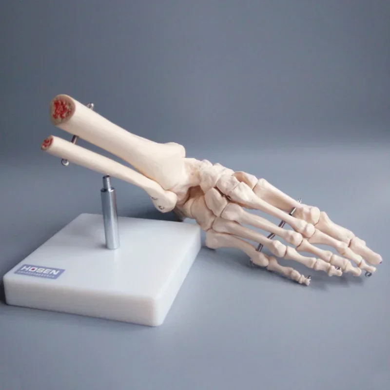 1 Foot Joint Medical Study Model - Foot Skeleton Bones Skeletal Anatomy Teaching Aid for Educational Purposes in Clinic Show