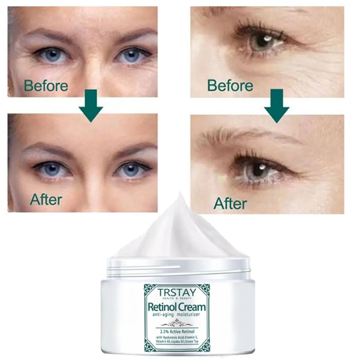 Active Retinol Cream reduces wrinkles for younger looking skin firming skin tightening cream