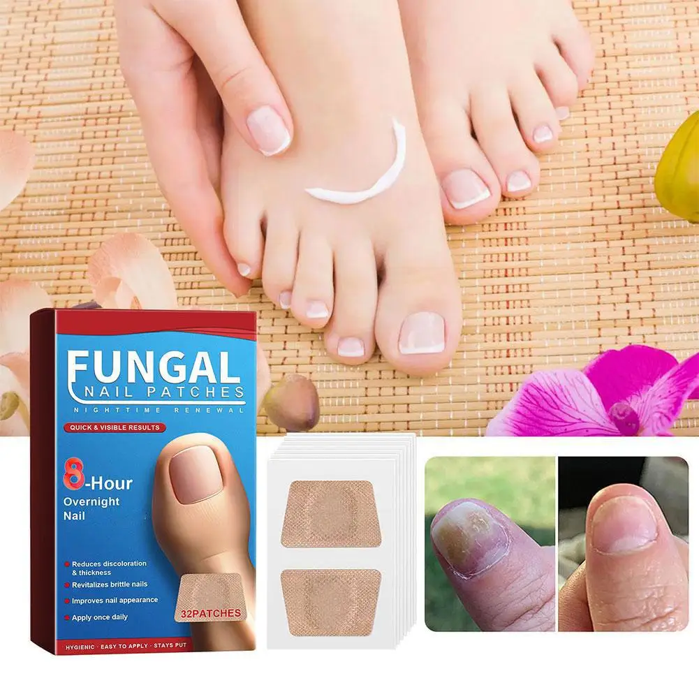 القدم مسمار رقعة إصلاح الإطارات رمادي الفطرية مسمار رشاقته لينة بارونيشيا ملصق اليد مسمار نام تصحيح أظافر العدوى S1C7 #3