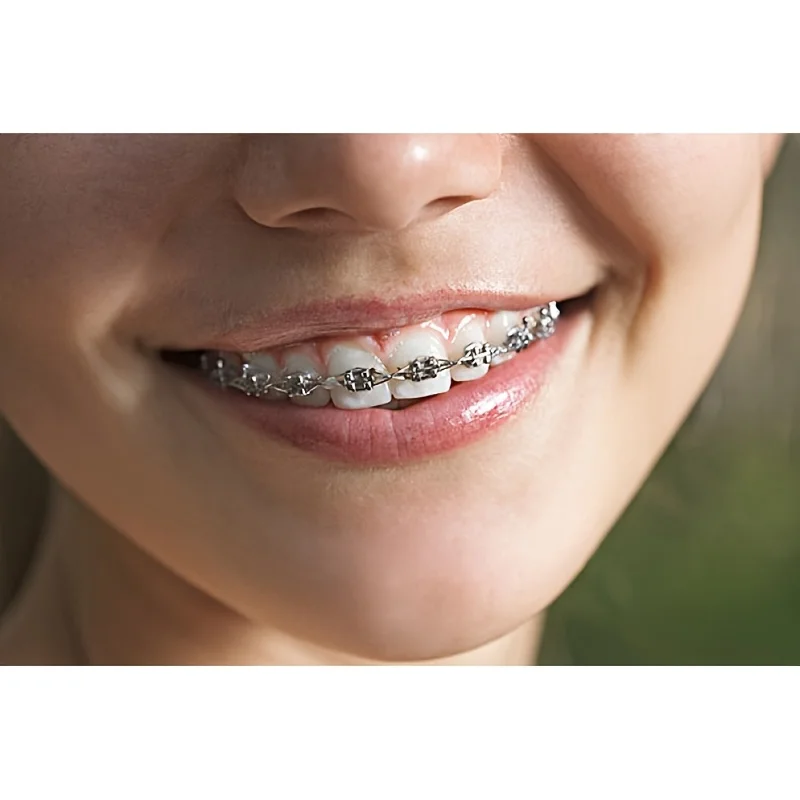 1 Paar modisches Zahndekorationsset mit Metallkette – verbessertes Dentalmodell-Set für obere/unterere Passform, tägliche Partykleidung – Detail 1
