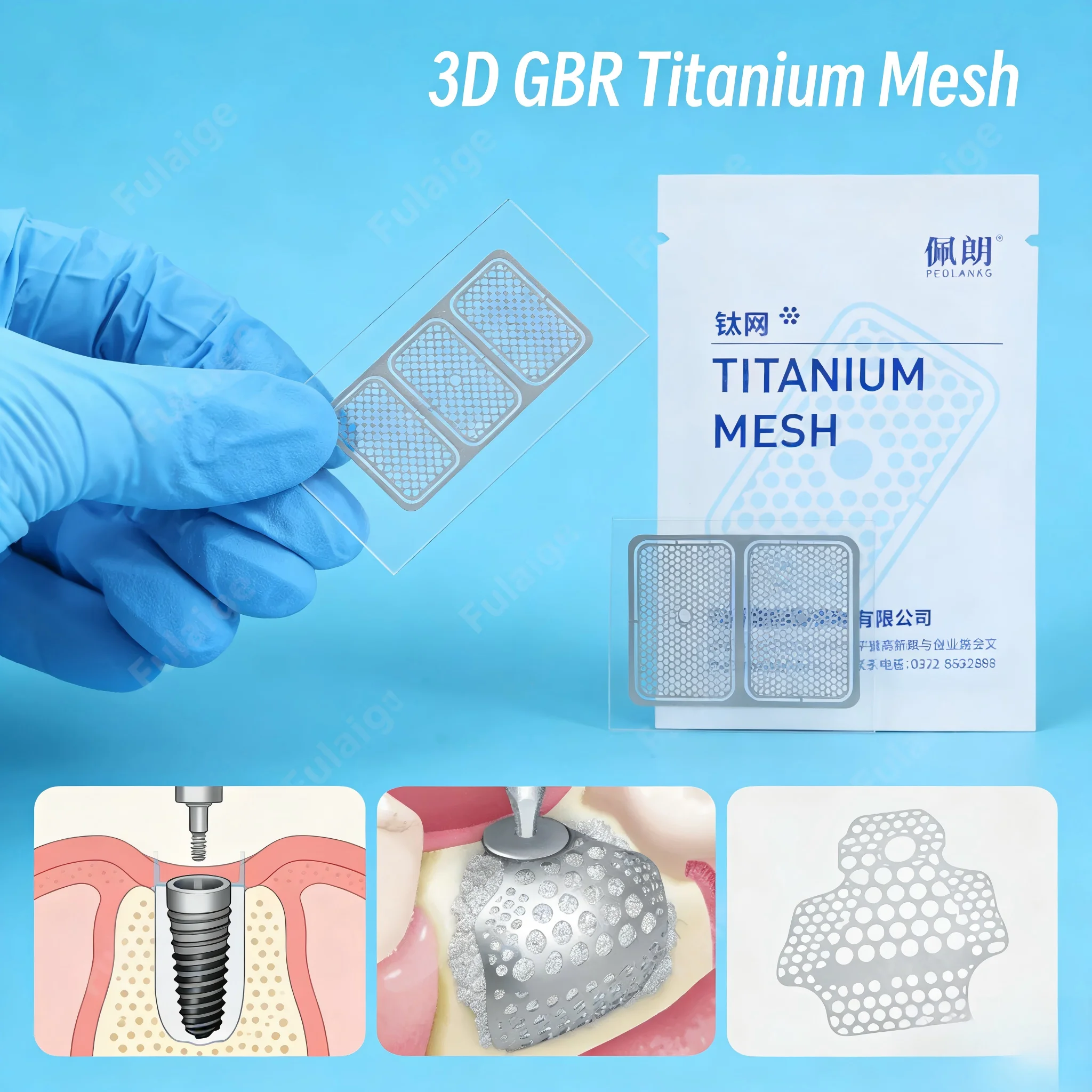 

5Bags/10Bags Dental GBR 3D Titanium Mesh Guided Bone Regeneration Membrane Plate for Implant Bone Formation Incremental