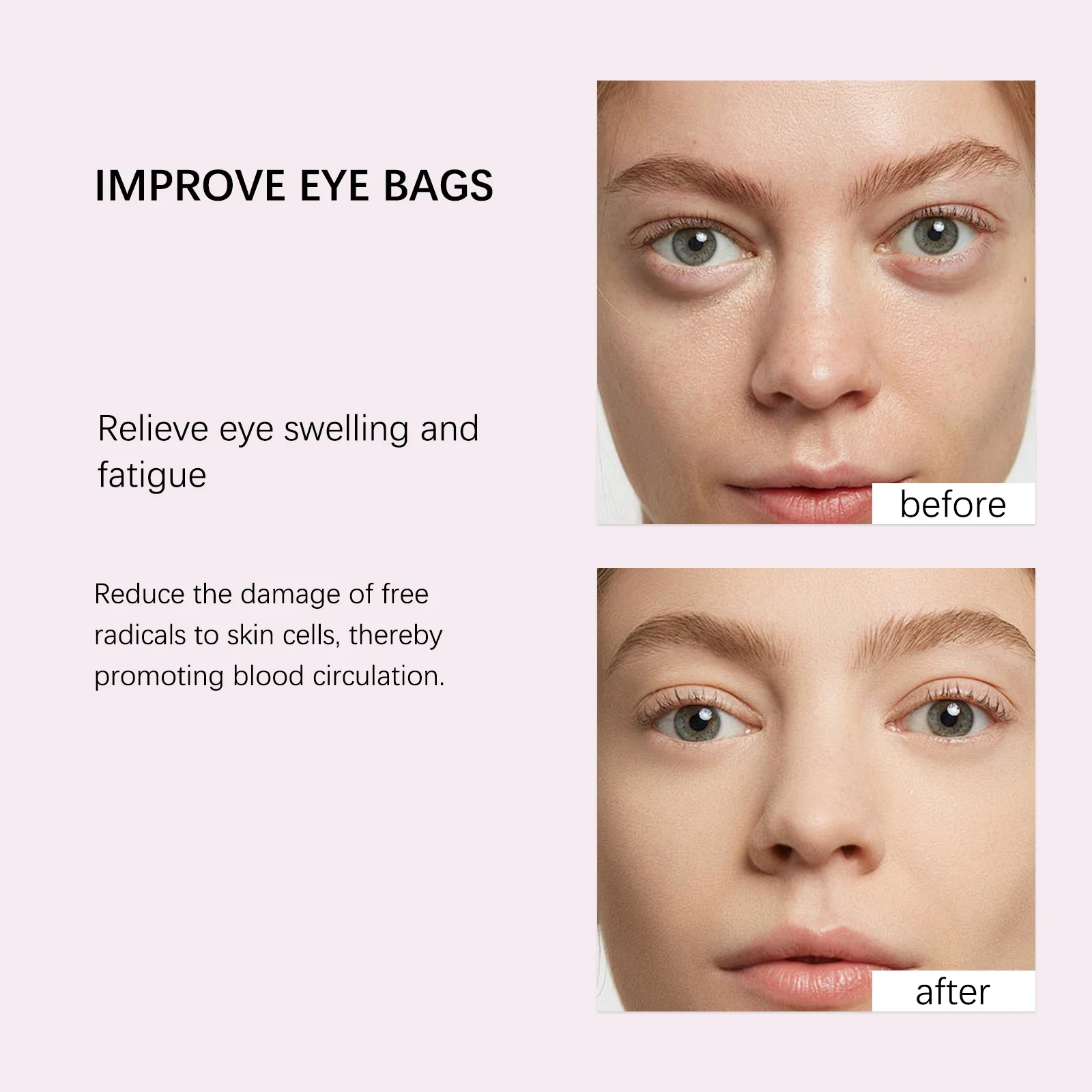 GROEI Anti Edema Eye Essence 10ml Under Eye Brightener for Dark Circles Anti-Aging Puffy Eyes, Eye Bags & Wrinkles Treatment