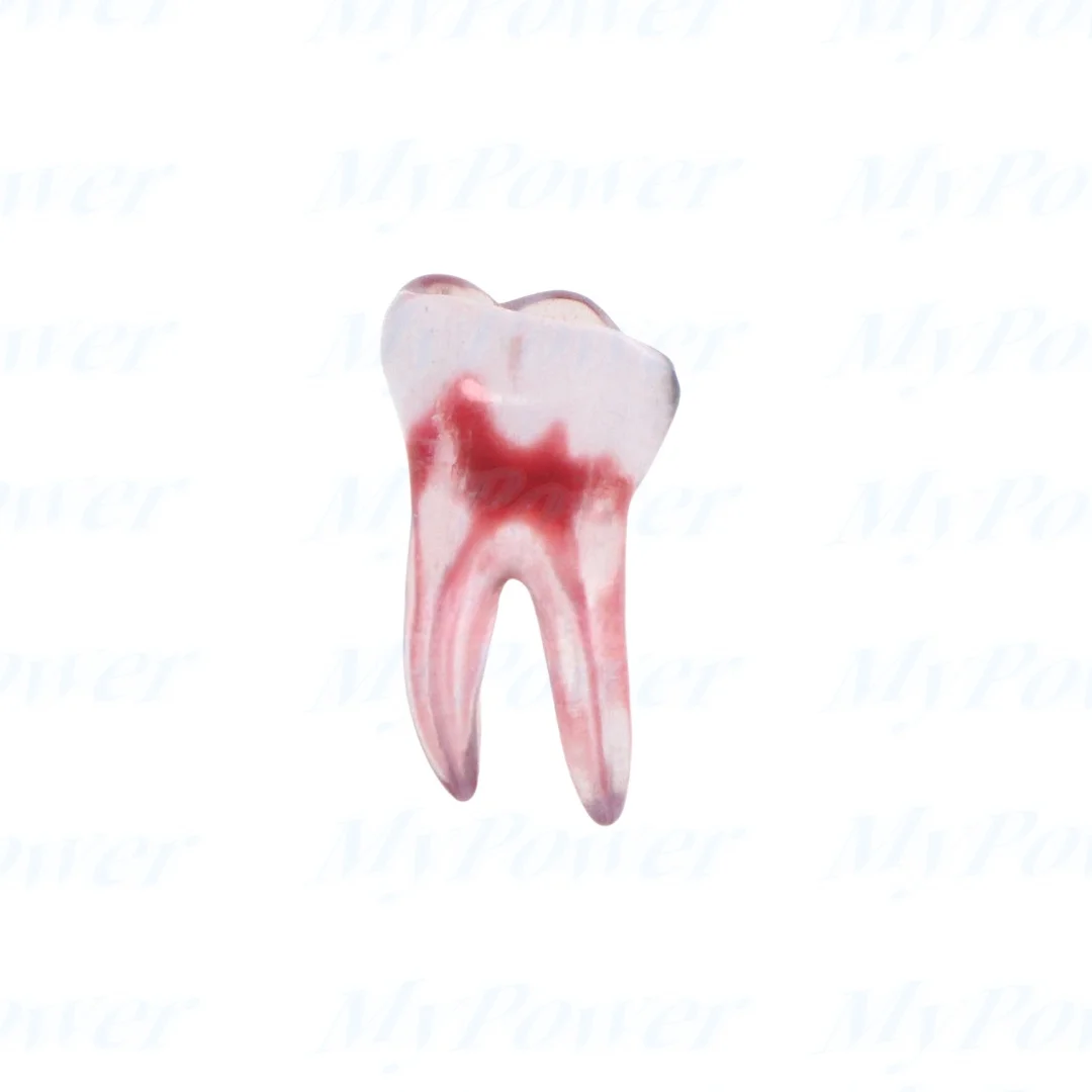 Tandheelkundige Training 3d Rct Endo Tandmodel Oefenmodel Gebogen Wortelhars Tanden
