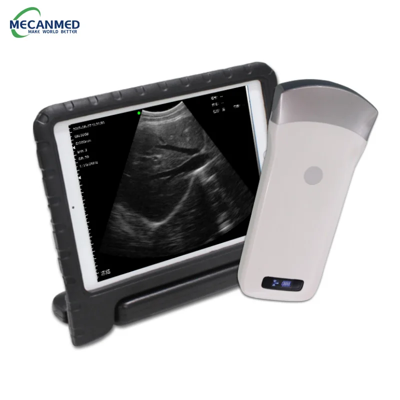 

Mecanmed One Stop Medical Supplier Portable Wireless Ultrasound Probe Wireless Convex Array Probe