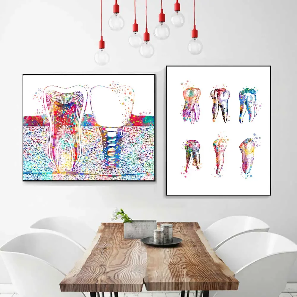 Dental Art Picture Tooth Implant Canvas Print Dentist Wall Art Painting Medicine Hygienist Poster Tooth Clinic Decor