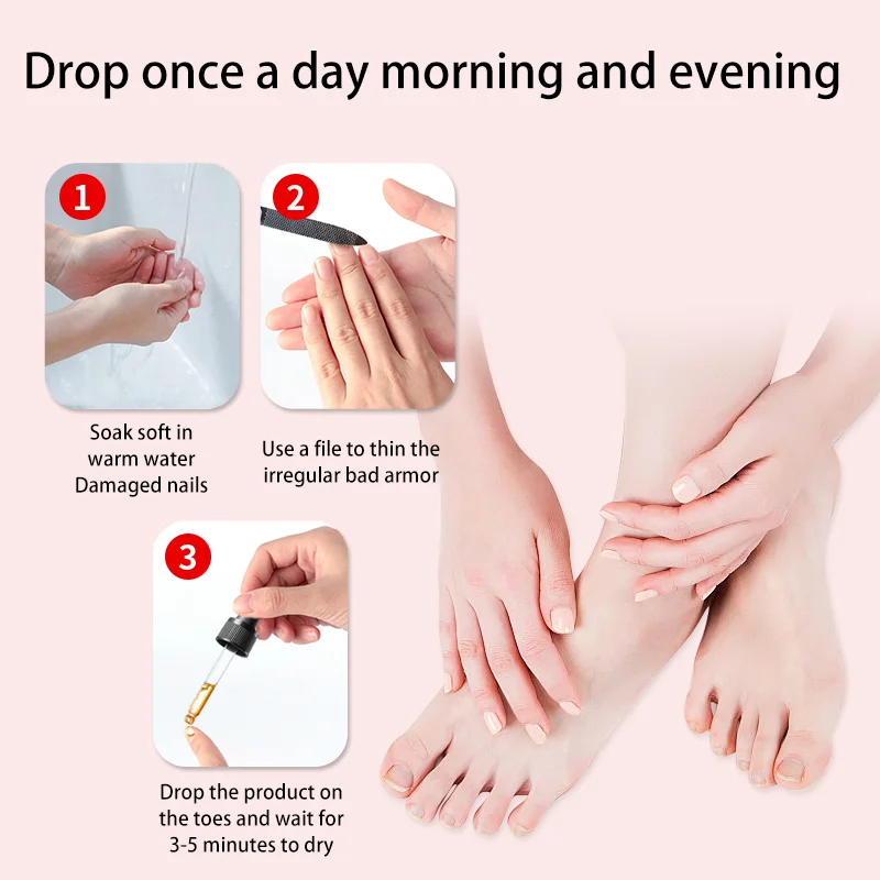 Zehennagel Nagel Pilz Behandlung Serum Fuß Reparatur Flüssigkeit Entfernung Ätherische Öle Fuß Nagel Pilz Reparatur Gel Hand Fuß Pflege