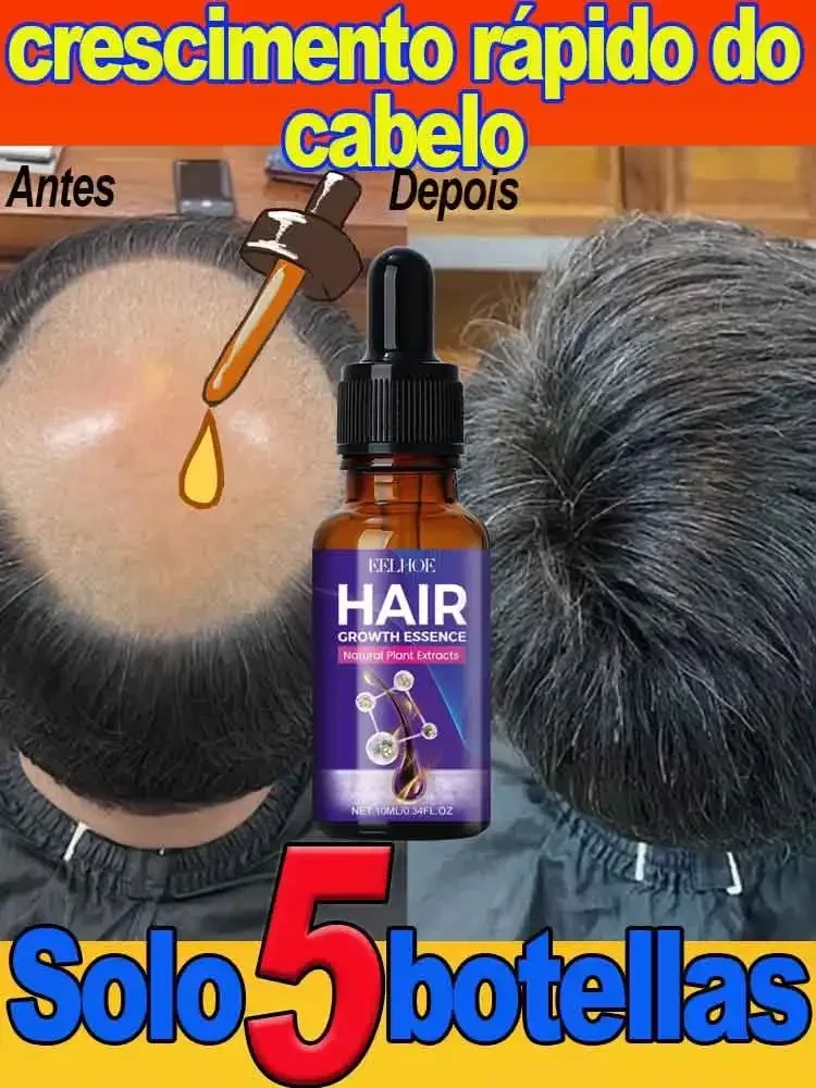 

Hot sale, buyers will buy again, hair is getting more and more, say goodbye to baldness, sparse hair starts to become thick.