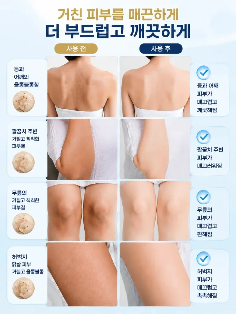 1+1 Niacinamide Skin Renewal & Whitening Soap, Whitening Beauty Soap, Hypoallergenic, Brightens Dark Spots, Moisturizing, Soothing, Face Whitening, Body Whitening, Whole Body Whitening 썸네일 3