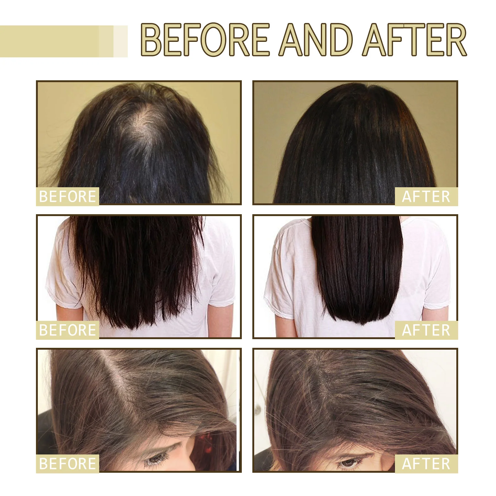 60ml Rosemary Dense Hair Essential Oil Repairs Hair Damage Prevent Hair Loss Soften Hair Strengthen Hair Roots Nourishe Hair Oil image 3