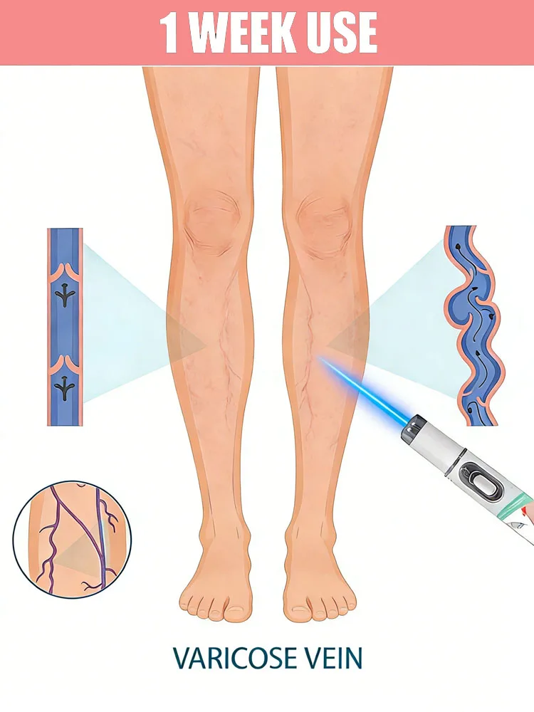 

Самый продаваемый инструмент для ухода за ногами с синим светом, защищающий ваше здоровье, с ещё большими скидками при покупке в комплектах.