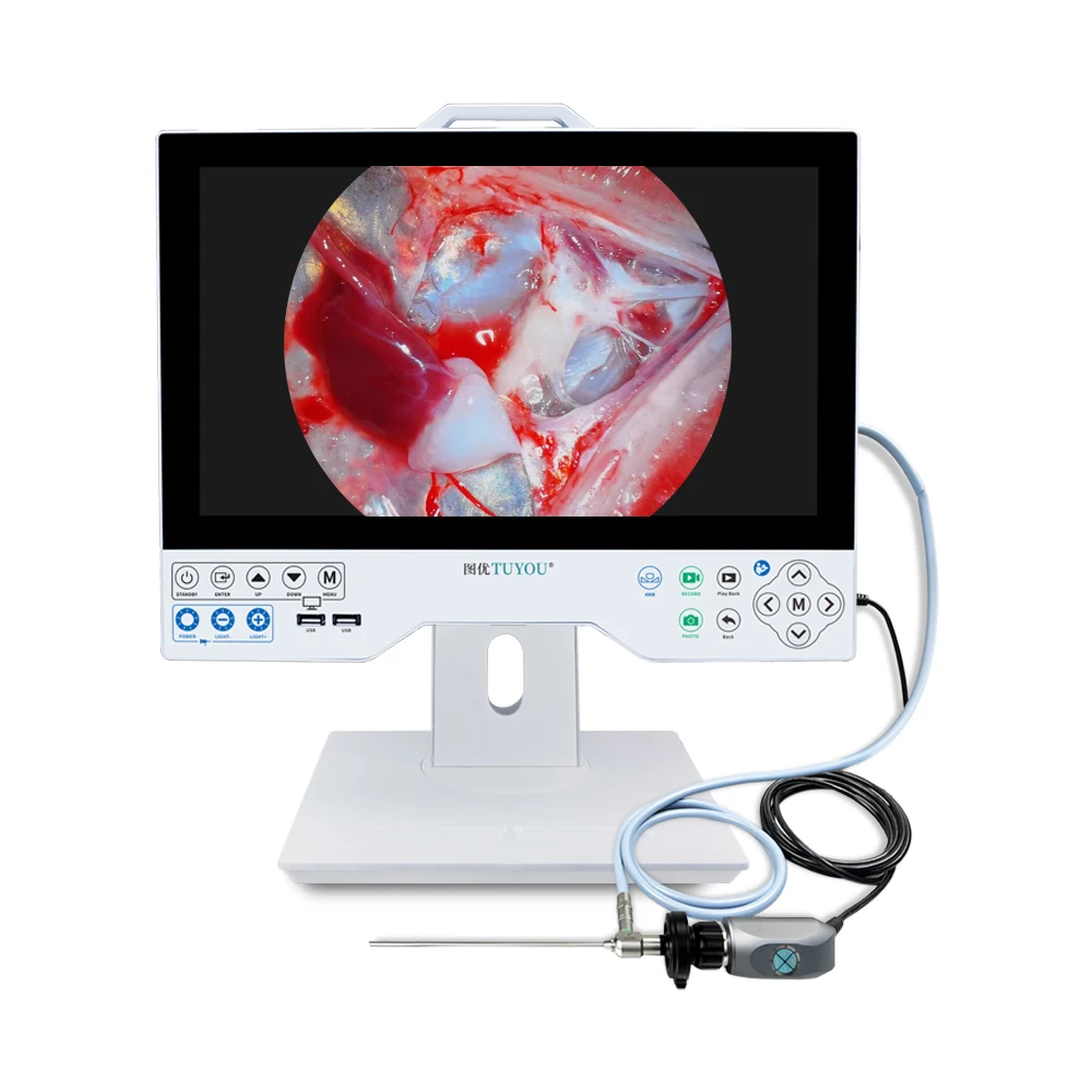 TUYOU 15.6 INCH All In One only Rigid Endoscopy Camera Full HD Endoscope Record System For  ENT