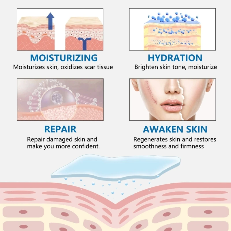 Phẫu thuật sinh mổ hiệu quả Gel Silicone Loại bỏ sẹo Tấm trị liệu Miếng dán trị mụn Chấn thương Đốt cháy Da phục hồi