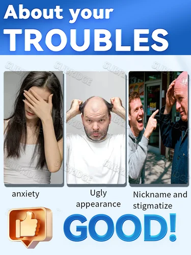 Imagen 2 del producto Envío gratis, aplicador de cuero cabelludo, Mini masajeador de cabeza, cepillo de bola, aplicador de líquido para el crecimiento del cabello, combinación de peine de masaje