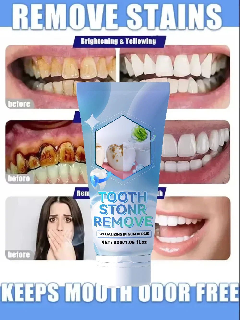 إصلاح الأسنان، ويمنع تساقط الأسنان، وإزالة لوحة الأسنان بشكل فعال #3