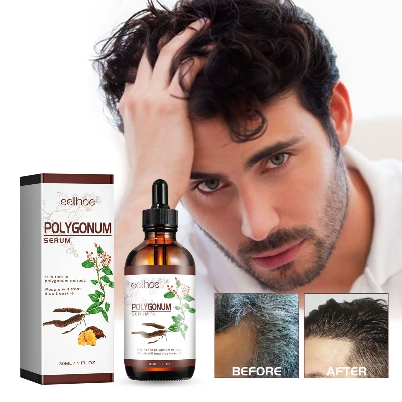 

Polygonum Hair Serum - Nourishing Treatment For Dry Gray Hair, Helps Enhance Shine & Improve Hair Texture Naturally