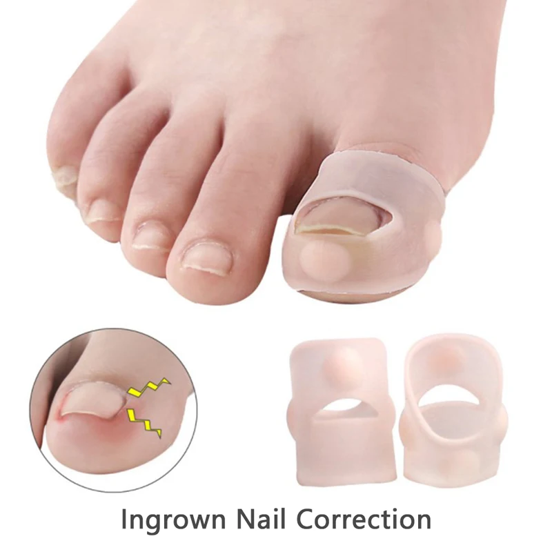 1Pair Invisible Toe Nail Treatment Silicone Ingrown Toenail Correction Tool