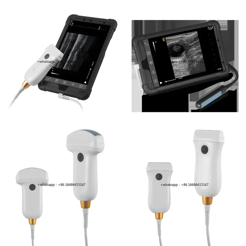 Sale Portable B/W Android Veterinary Probe For Livestock