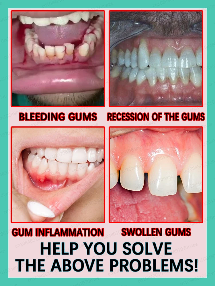 Repair gums, no more worries