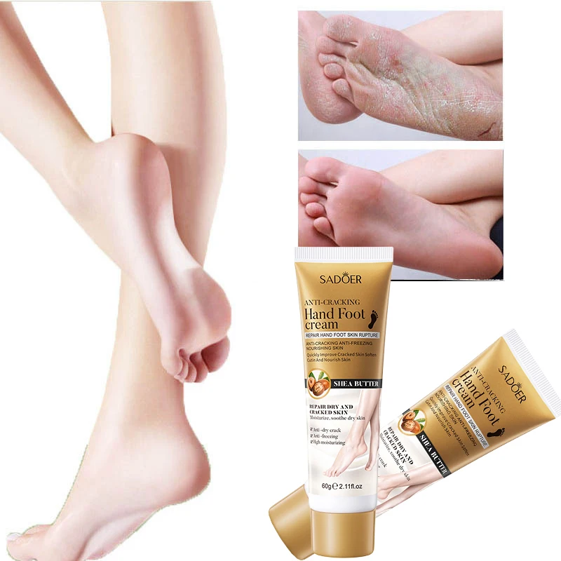 Crema de pies para talón seco y agrietado, Exfoliante para pies, eliminador de piel muerta, aclara, crema hidratante de manos, productos para el cuidado de los pies, 60g