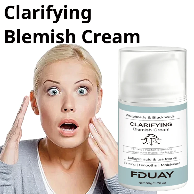 FDUAY Salicylic Acid  Tea Tree Oil Acne Clearing Repair Cream - Fades Acne Marks Smoothes Skin for Clearer Complexion50g