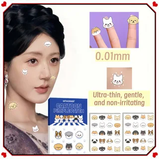 Plester Jerawat Hidrokoloid, 396 Pcs - Penutup Tak Terlihat untuk Jerawat & Noda, Semua Warna Kulit Terang