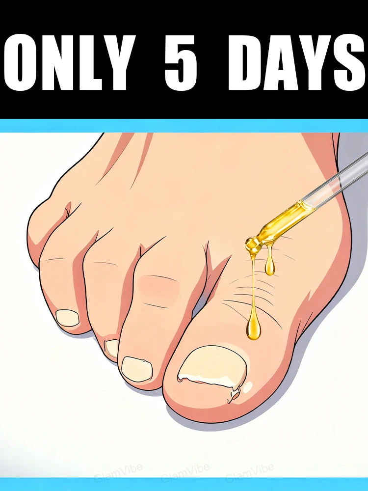 

Solve the troubles of fingers and toes 2025 hot sale