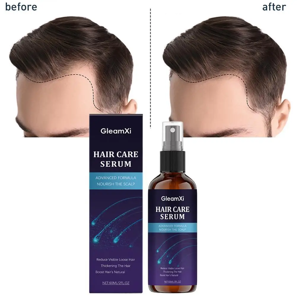 

Rosemary Water For Hair Growth Rosemary Oil Spray Hair Mint Thickening Strengthening Natural Rosemary Essential Oil Hair Care