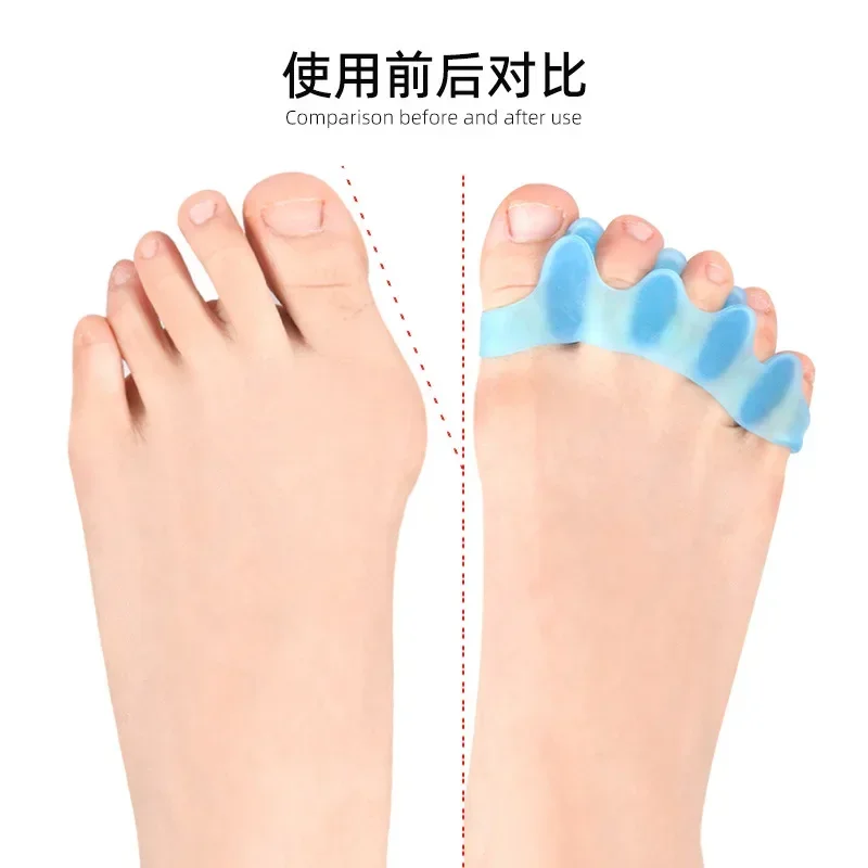 1Pair Protective Toes Separator  Suitable Bunion Corrector  Material Soft Gel Straightener Separador De Dedos Del Pie