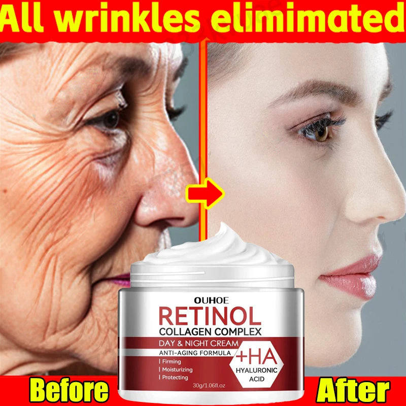 

Retinol Wrinkle Remover Face Cream Firming Lifting Anti Aging Fade Fine Lines Moisturizing Whitening Repair Skin Care Cosmetics