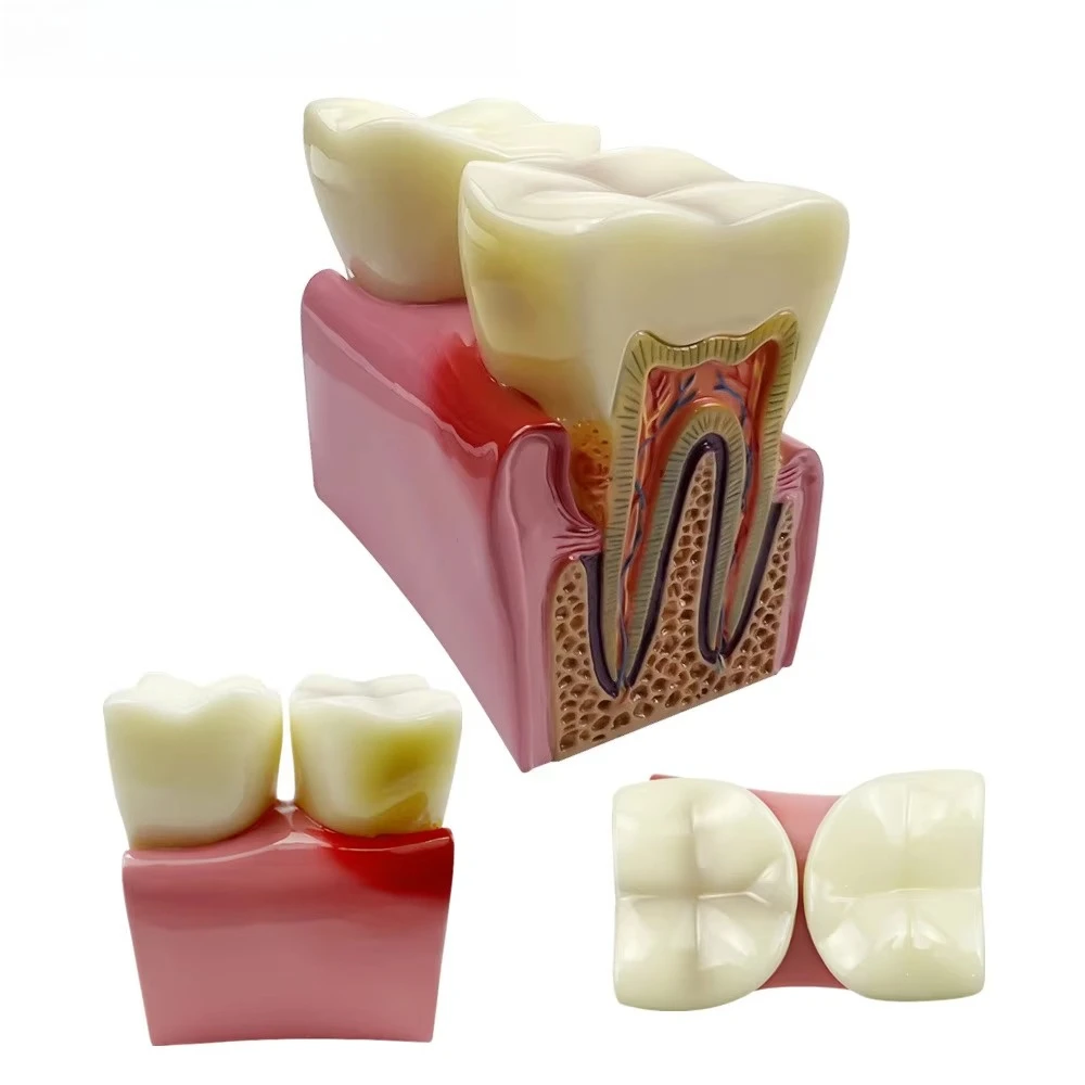 Big Dental Teeth Model Anatomy Large Dental Anatomical Model For Teaching Studying Education Demonstration Patient Communication