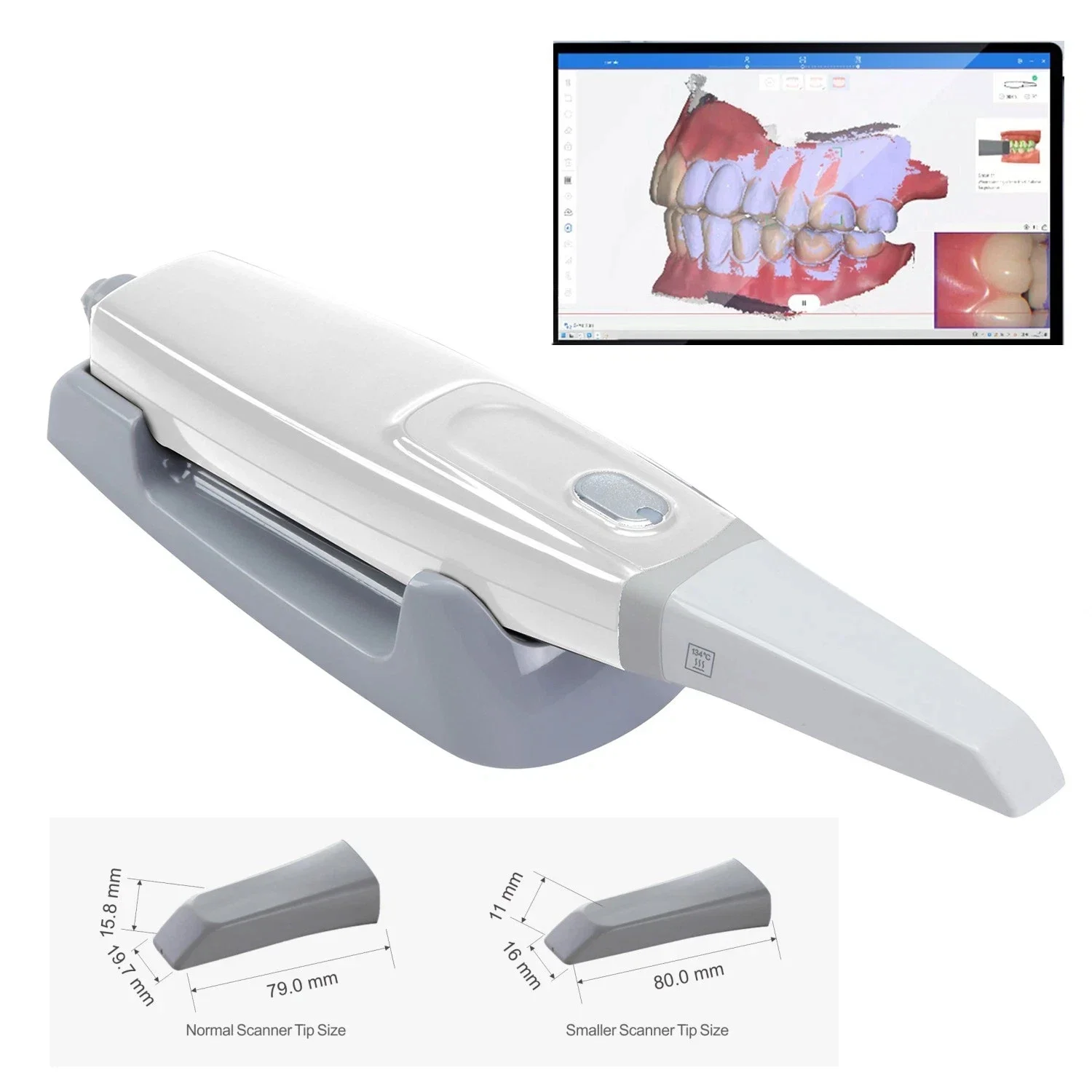 Intraoral Scanner 3D Display Dental Digital Imaging Intraoral Orthodontic Impression Device