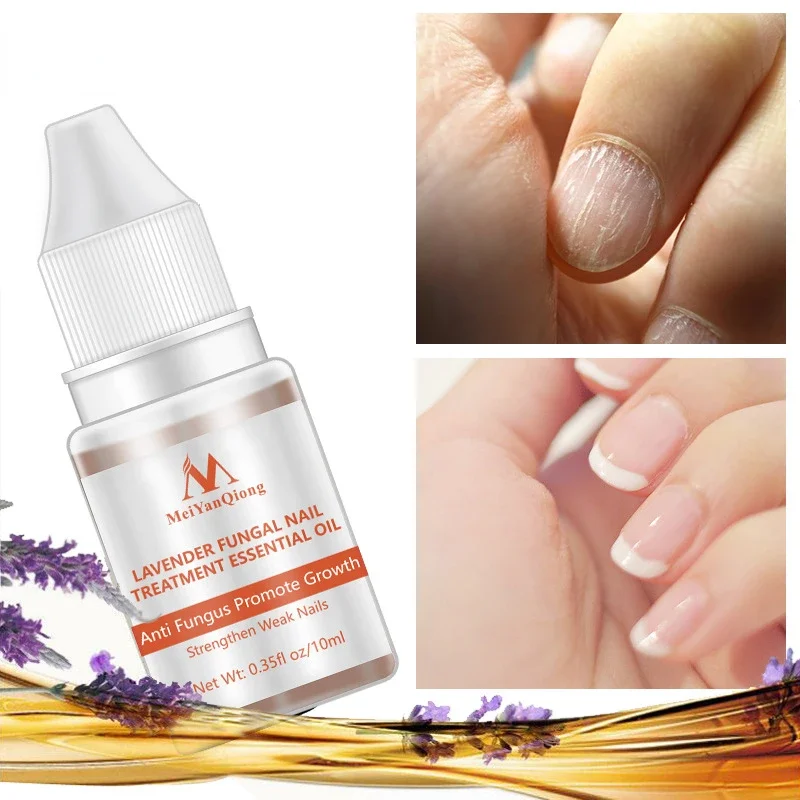 1 Fles 10Ml Gedroogde Bloemen Verzachter Nutritionele Nagelriemolie Behandeling Voedzame Gel Polish Cuticula Nail Art Tool Nagelverzorging Olie