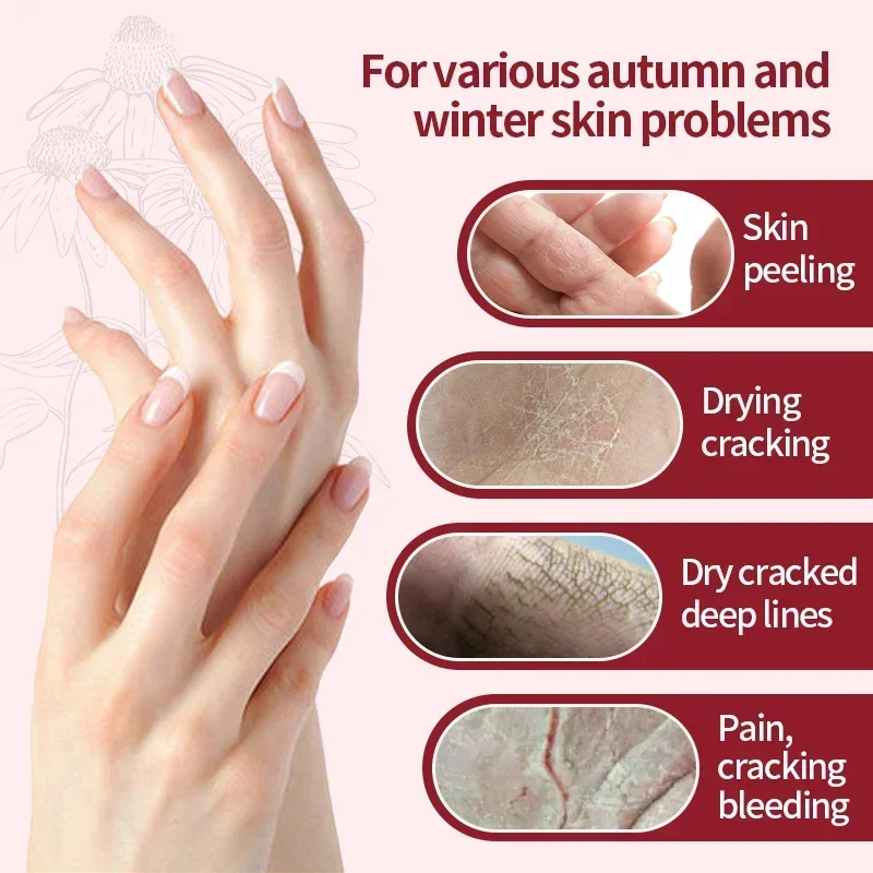 Falten entfernung Anti-Riss-Hand creme befeuchten Peeling Reparatur Handl otion Anti-Aging nähren Anti-Trocknung Weiß Hand pflege